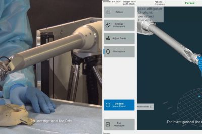 Galen Robotics looks to assist ENT surgeons with new bot and $15M round